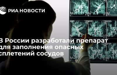 В России разработали препарат для заполнения опасных сплетений сосудов