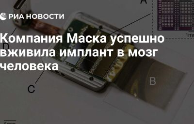 Компания Маска успешно вживила имплант в мозг человека