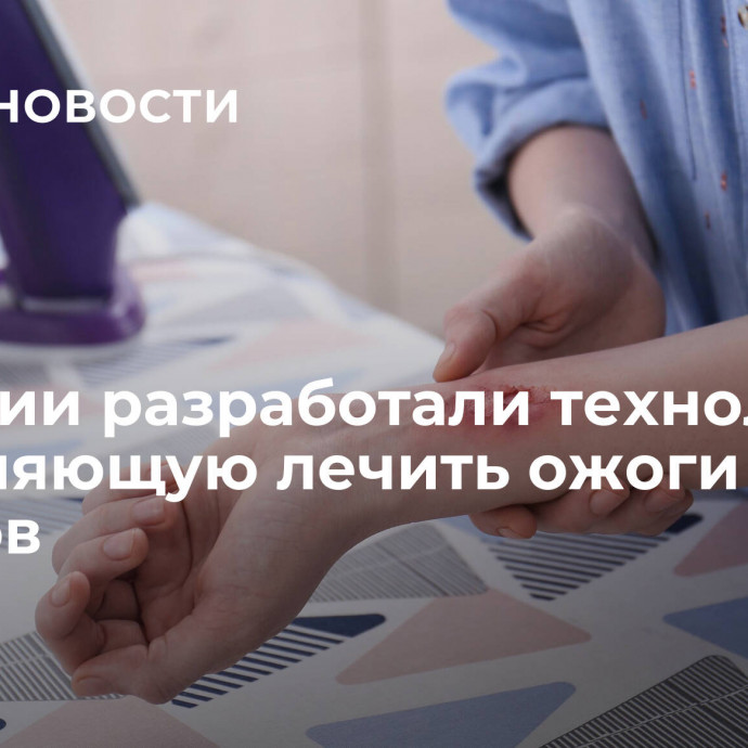 В России разработали технологию, позволяющую лечить ожоги без шрамов