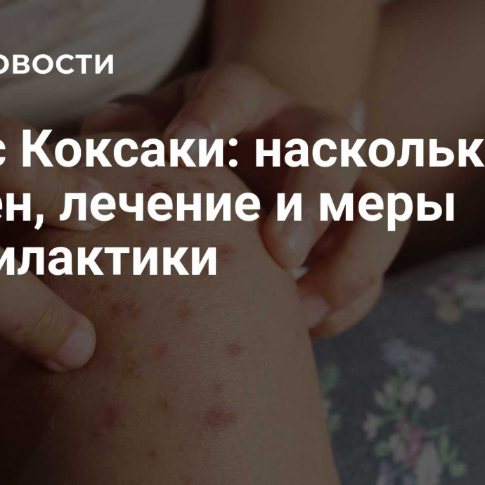 Вирус Коксаки: насколько опасен, лечение и меры профилактики