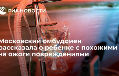 Московский омбудсмен рассказала о ребенке с похожими на ожоги повреждениями